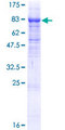 ITFG1 / TIP Protein - 12.5% SDS-PAGE of human ITFG1 stained with Coomassie Blue