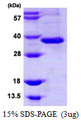 ITLN1 / Omentin Protein