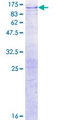 ITPKB Protein - 12.5% SDS-PAGE of human ITPKB stained with Coomassie Blue