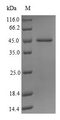JMJD1C Protein - (Tris-Glycine gel) Discontinuous SDS-PAGE (reduced) with 5% enrichment gel and 15% separation gel.