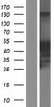 JSRP1 Protein - Western validation with an anti-DDK antibody * L: Control HEK293 lysate R: Over-expression lysate