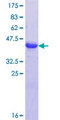 JSRP1 Protein - 12.5% SDS-PAGE Stained with Coomassie Blue.