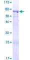 KAZN Protein - 12.5% SDS-PAGE of human RP1-21O18.1 stained with Coomassie Blue