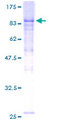 KBTBD2 Protein - 12.5% SDS-PAGE of human KBTBD2 stained with Coomassie Blue