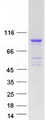 KBTBD6 Protein - Purified recombinant protein KBTBD6 was analyzed by SDS-PAGE gel and Coomassie Blue Staining