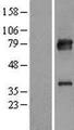 KBTBD7 Protein - Western validation with an anti-DDK antibody * L: Control HEK293 lysate R: Over-expression lysate