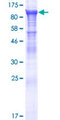 KBTBD7 Protein - 12.5% SDS-PAGE of human KBTBD7 stained with Coomassie Blue