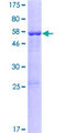 KCNRG Protein - 12.5% SDS-PAGE of human KCNRG stained with Coomassie Blue