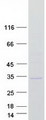 KCTD11 Protein - Purified recombinant protein KCTD11 was analyzed by SDS-PAGE gel and Coomassie Blue Staining