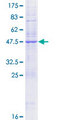 KDELR1 / HDEL Protein - 12.5% SDS-PAGE of human KDELR1 stained with Coomassie Blue