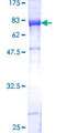 KIAA0368 / ECM29 Protein - 12.5% SDS-PAGE of human KIAA0368 stained with Coomassie Blue