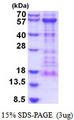 KIAA0513 Protein