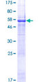 KIAA0825 Protein - 12.5% SDS-PAGE of human C5orf36 stained with Coomassie Blue