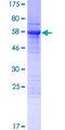 KIAA1191 Protein - 12.5% SDS-PAGE of human KIAA1191 stained with Coomassie Blue