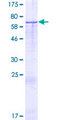KIAA1683 Protein - 12.5% SDS-PAGE of human KIAA1683 stained with Coomassie Blue