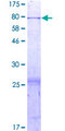 KIAA1826 Protein - 12.5% SDS-PAGE of human KIAA1826 stained with Coomassie Blue