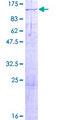 KIF3C Protein - 12.5% SDS-PAGE of human KIF3C stained with Coomassie Blue