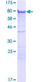 KLC3 Protein - 12.5% SDS-PAGE of human KLC3 stained with Coomassie Blue
