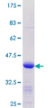 KLF8 Protein - 12.5% SDS-PAGE Stained with Coomassie Blue.