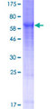 KLHDC1 Protein - 12.5% SDS-PAGE of human KLHDC1 stained with Coomassie Blue