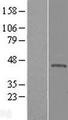 KLHDC3 Protein - Western validation with an anti-DDK antibody * L: Control HEK293 lysate R: Over-expression lysate