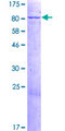 KLHL12 Protein - 12.5% SDS-PAGE of human KLHL12 stained with Coomassie Blue