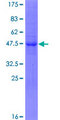 KLHL17 Protein - 12.5% SDS-PAGE of human KLHL17 stained with Coomassie Blue