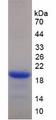 KLRD1 / CD94 Protein - Recombinant Killer Cell Lectin Like Receptor Subfamily D, Member 1 By SDS-PAGE