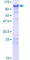 KPNB1 / Importin Beta Protein - 12.5% SDS-PAGE of human KPNB1 stained with Coomassie Blue