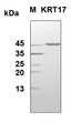 KRT17 / CK17 / Cytokeratin 17 Protein