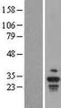 KRT18P55  Protein - Western validation with an anti-DDK antibody * L: Control HEK293 lysate R: Over-expression lysate