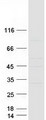 KRT18P55  Protein - Purified recombinant protein FLJ40504 was analyzed by SDS-PAGE gel and Coomassie Blue Staining