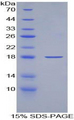 KRT19 / CK19 / Cytokeratin 19 Protein - Recombinant Keratin 19 By SDS-PAGE