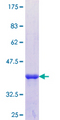 KRT36 / Keratin 36 / KRTHA6 Protein - 12.5% SDS-PAGE Stained with Coomassie Blue