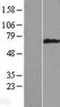 KRT6B / CK6B / Cytokeratin 6B Protein - Western validation with an anti-DDK antibody * L: Control HEK293 lysate R: Over-expression lysate