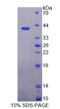 KRT6C / CK6C / Cytokeratin 6C Protein - Recombinant  Keratin 6C By SDS-PAGE
