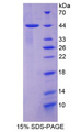 KRT7 / CK7 / Cytokeratin 7 Protein - Recombinant Keratin 7 By SDS-PAGE