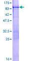 KRT76 / Keratin 76 Protein - 12.5% SDS-PAGE of human KRT76 stained with Coomassie Blue