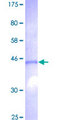 KRTAP13-1 Protein - 12.5% SDS-PAGE of human KRTAP13-1 stained with Coomassie Blue
