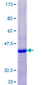 KRTAP13-3 Protein - 12.5% SDS-PAGE of human KRTAP13-3 stained with Coomassie Blue