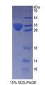 KTN1 / Kinectin Protein - Recombinant  Kinectin 1 By SDS-PAGE