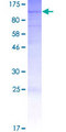 L3MBTL2 Protein - 12.5% SDS-PAGE of human L3MBTL2 stained with Coomassie Blue