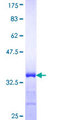 L3MBTL2 Protein - 12.5% SDS-PAGE Stained with Coomassie Blue.
