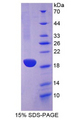 LALBA / Alpha Lactalbumin Protein - Recombinant Alpha-Lactalbumin By SDS-PAGE