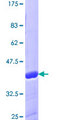 LAMTOR3 / MP1 Protein - 12.5% SDS-PAGE of human MAPKSP1 stained with Coomassie Blue