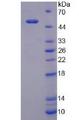 LBP Protein - Recombinant Lipopolysaccharide Binding Protein By SDS-PAGE