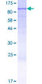 LCA3 / SPATA7 Protein - 12.5% SDS-PAGE of human SPATA7 stained with Coomassie Blue