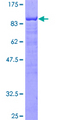 LCP2 / SLP-76 Protein - 12.5% SDS-PAGE of human LCP2 stained with Coomassie Blue