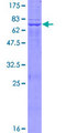 LDHAL6B Protein - 12.5% SDS-PAGE of human LDHAL6B stained with Coomassie Blue