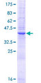 LGALS14 / CLC2 Protein - 12.5% SDS-PAGE of human LGALS14 stained with Coomassie Blue